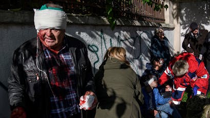 Man met hoofdwond in Oekraïne